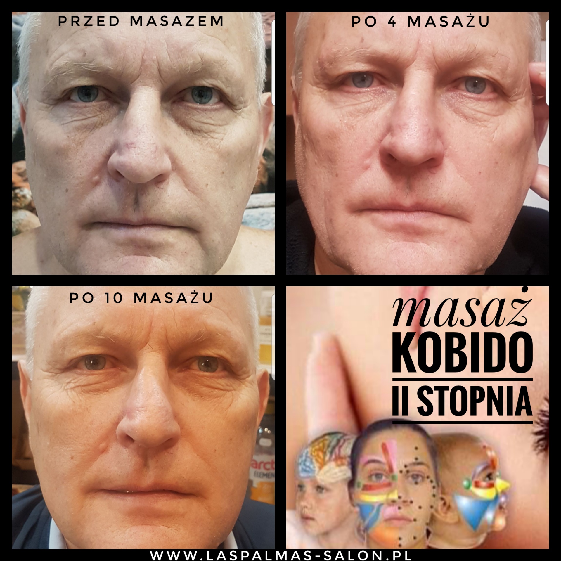 Masaż twarzy Kobido - efekty